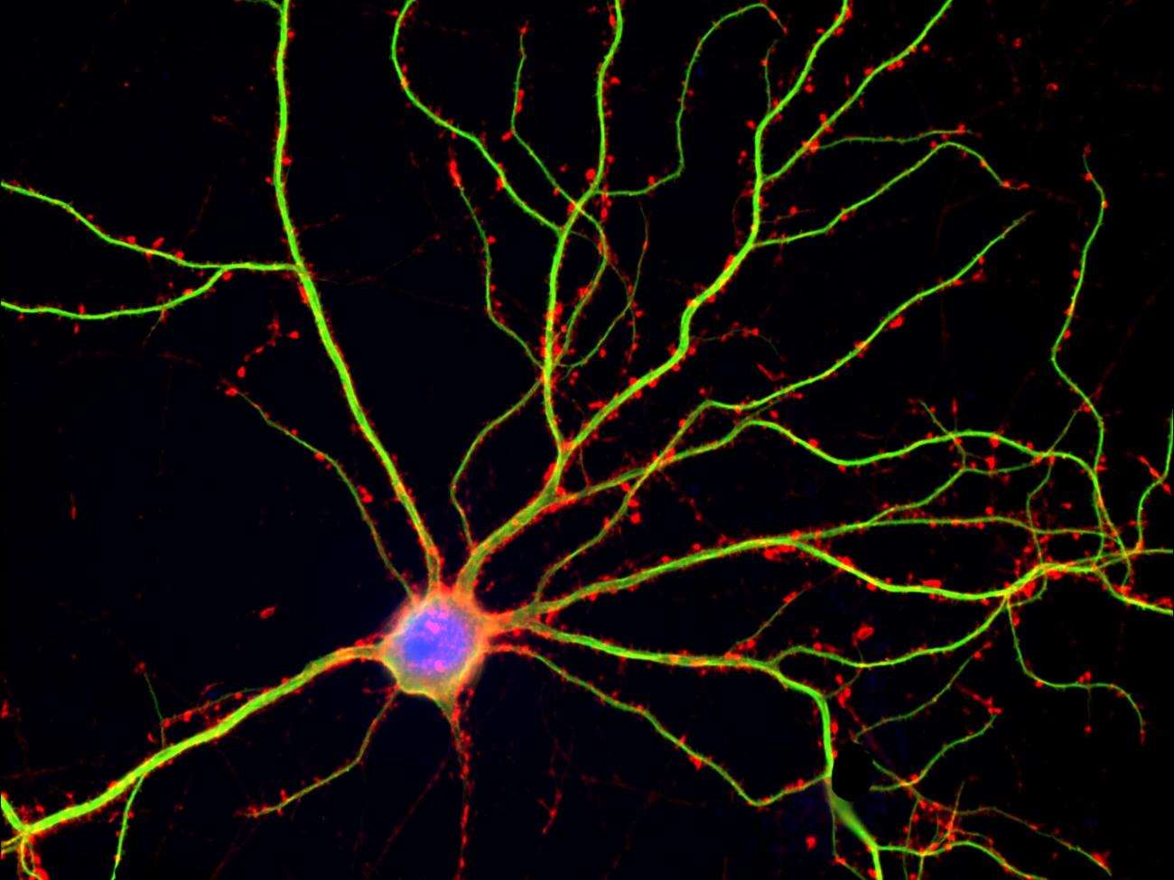 UCSD targets dendritic spines in promising Alzheimer's approach