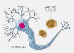 SBP and GSK Create New Center for Translational Neuroscience