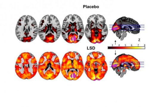 Brain on LSD revealed: First scans show how the drug affects the brain