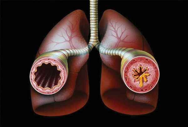 OncoArendi Therapeutics Announces Selection of Its First Clinical Development Candidate for the Treatment of Asthma