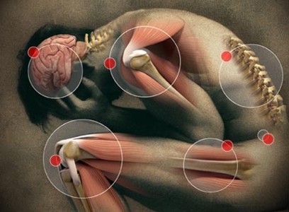 Iroko Pharmaceuticals Receives FDA Approval for VIVLODEX- First Low Dose SoluMatrix? Meloxicam for Osteoarthritis Pain